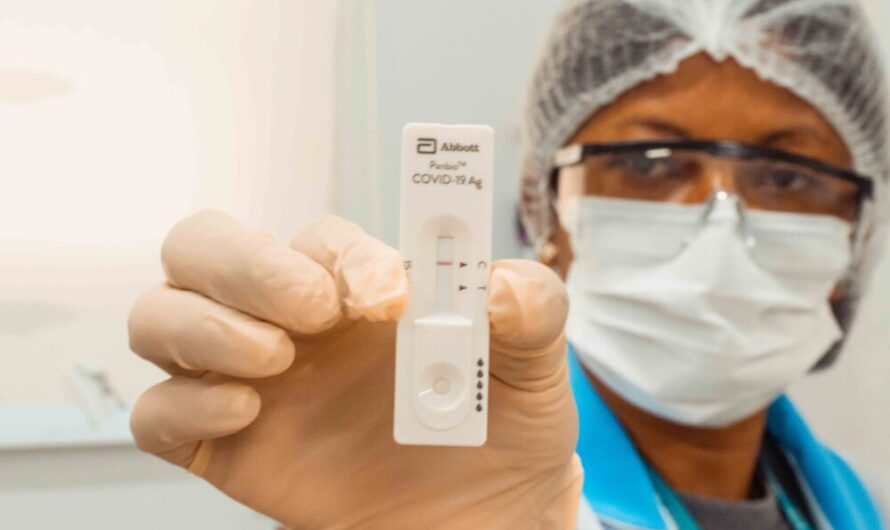 APAE DE SÃO LUÍS REALIZA MAIS DE 400 TESTES RÁPIDOS PARA COVID-19