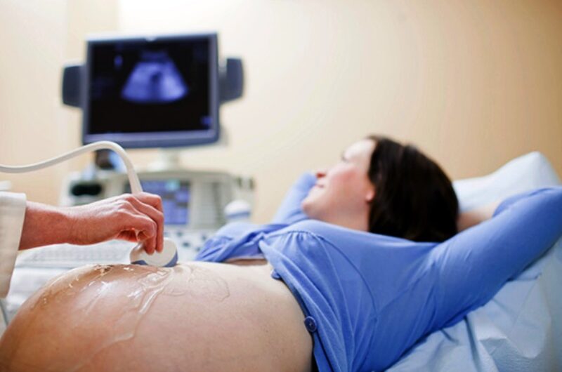 Ultrassonografia do iMedical Presidente Dutra amplia monitoramento da saúde dos bebês e futuras mamães