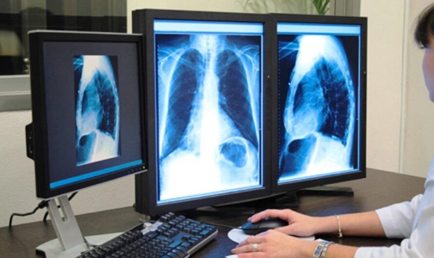 iMedical Presidente Dutra faz diagnóstico por exames de imagem em atletas lesionados