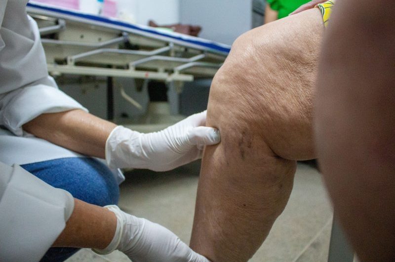Governo investe no serviço de reumatologia na Policlínica Vinhais